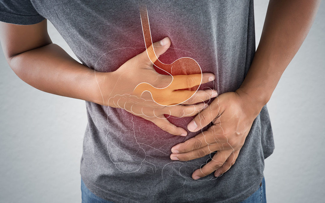 Abdominal Pain Got You Down? It May Be IBS!