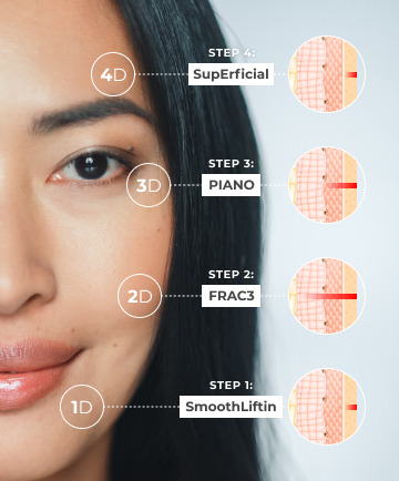 fotona-laser-facial-skin-tightening